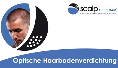 scalp OPTIC HAIR - Optische Haarbodenverdichtung | RPM Medical & Kosmetik Rafael-Peter Mischewski Mönchengladbach
